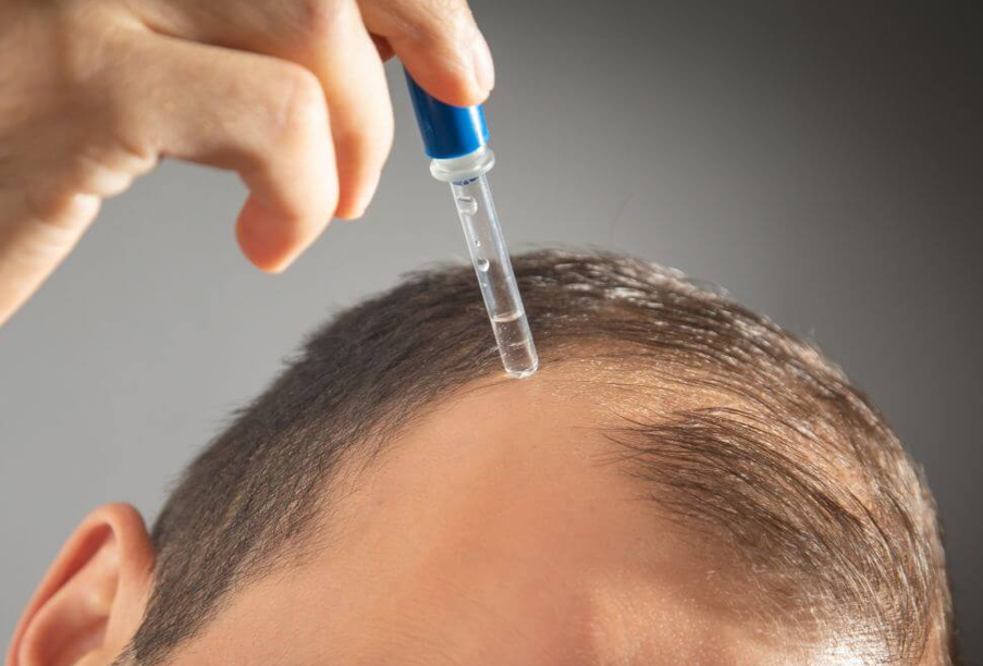 Redensyl vs Minoxidil​: What Are The Differences?