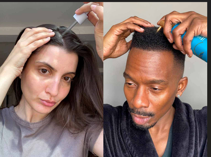 Not Working Yet? Learn How to Apply Minoxidil Correctly